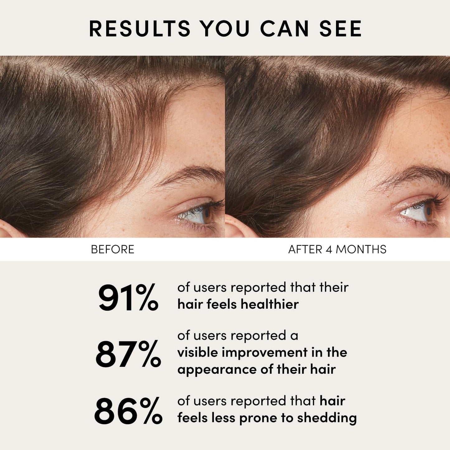 OUAI Scalp Serum - Balancing Hair Serum with Red Clover Extract, Siberian Ginseng and Peptides for Thicker and Fuller-Looking Hair - Paraben, Phthalate and Sulfate Free Scalp Care (2 Fl Oz)