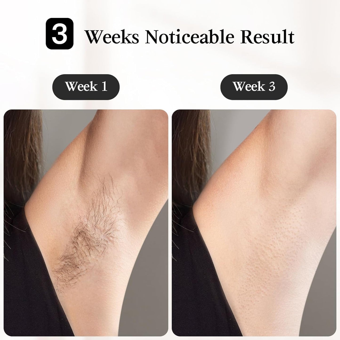 JOVS Laser Hair Removal, IPL Hair Removal for Women and Men, 37°F Painless Sapphire Ice-Cooling Tech, 6 Modes for Whole Body Hair Removal Device, 2 in 1 Skin Rejuvenation, 330° Rotation